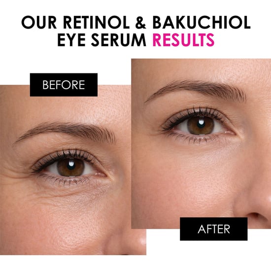 skinChemists Retinol & Bakuchiol Anti-Aging Oogserum 15ml - Image 3